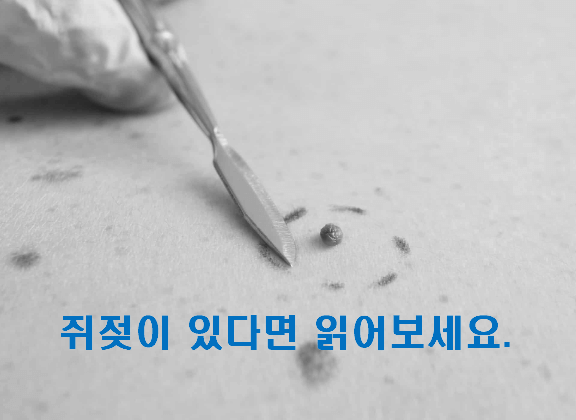 [필독] 쥐젖이 있다면 꼭 읽어보세요.