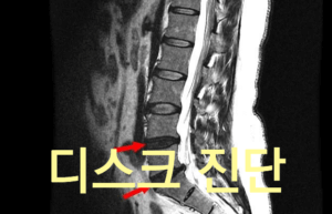 MRI 에 대한 궁금증 5가지