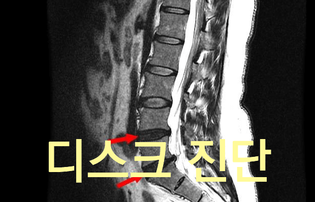 MRI 에 대한 궁금증 5가지
