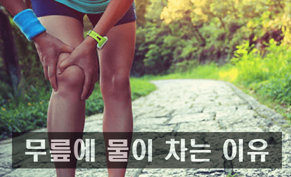 [최신] 무릎에 물 차는 이유 및 치료